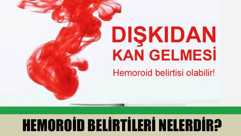 Hemoroid belirtileri
